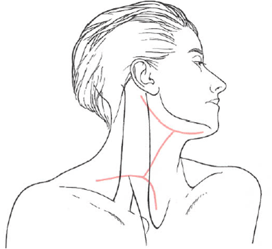 Double-Y Incision/ Slaughter incision