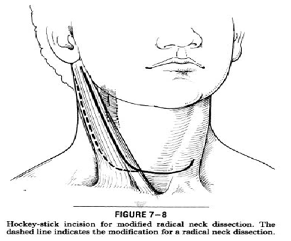 Half Apron Incision/ Hockey stick incision