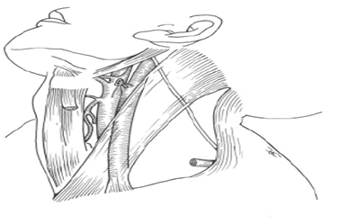 Head and Neck Dissection 27