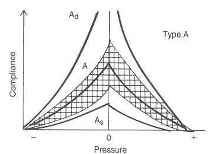 Tympanometry